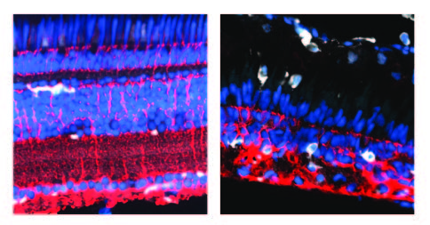 muller glia and regenerated retina in zebrafish